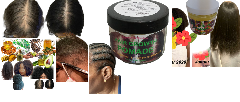 Hair Growth Pomade Grease with Mango butter, Peppermint Oil, Tea Tree Oil, Argan oil, Jojoba seed, Avocado oil, Castor oil, Sweet Almond, Vitamin E Oil for Scalp and Hair - Organic Hair Solution, LLC