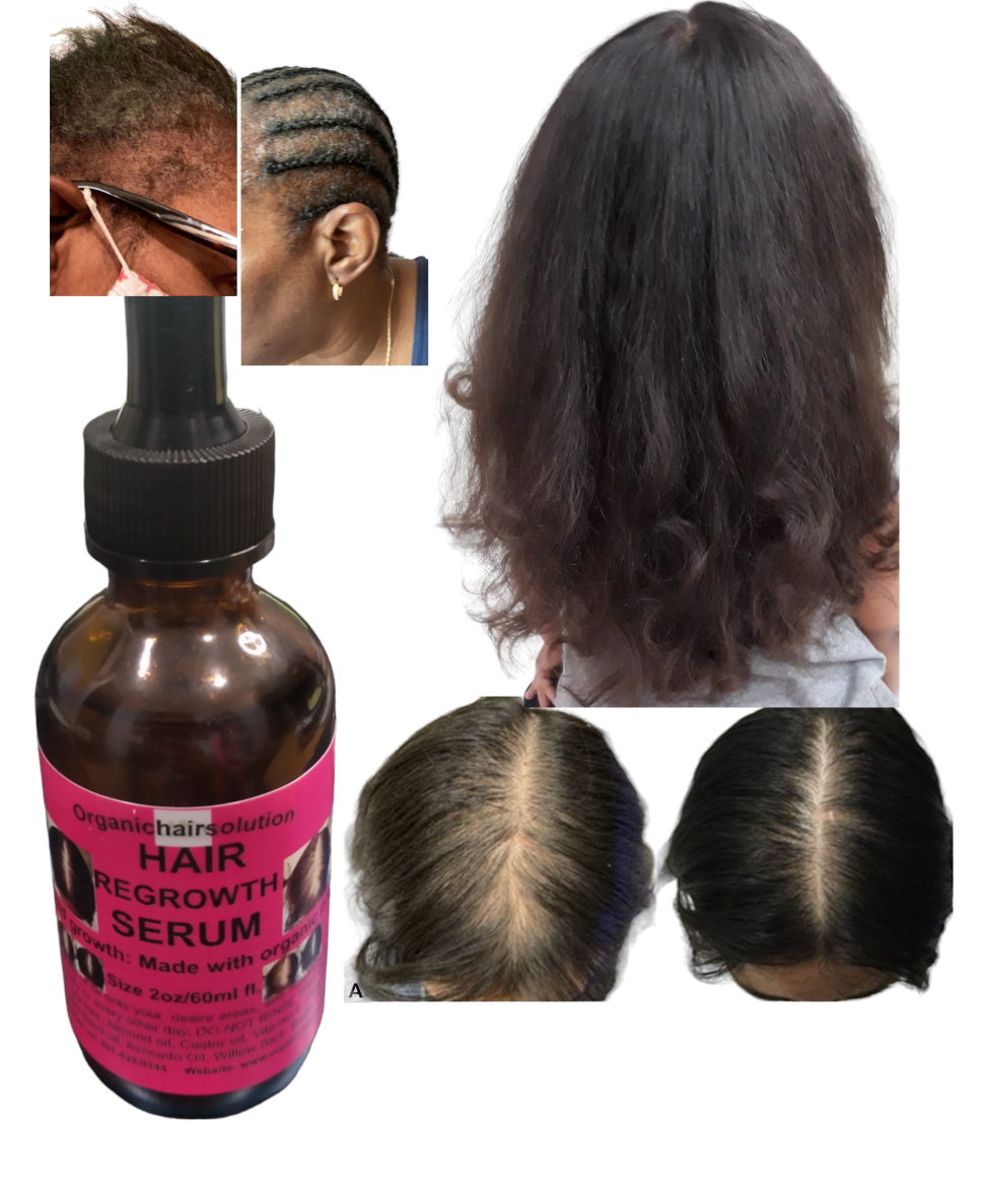 Hair Growth Bundle- For Stronger, Thicker Longer Hair-for Split Ends and Dry Scalp- (Set 6) All Hair types, Sulfate Free - Organic Hair Solution, LLC