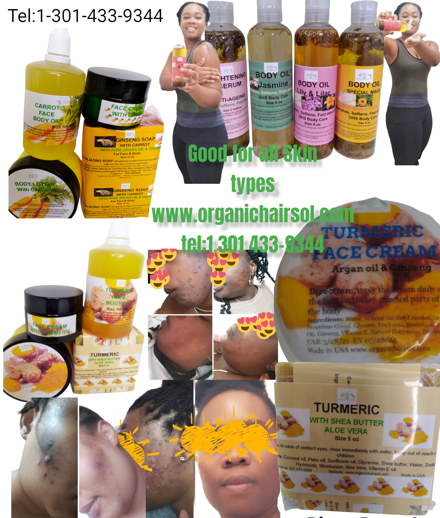 DARK SPOT CORRECTOR-Skin Pigmentation Solution-Discoloration Corrector - Organic Hair Solution, LLC