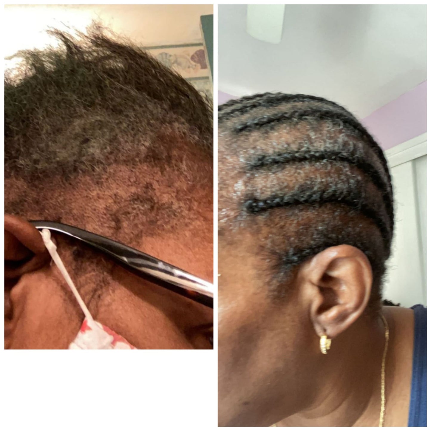 Pro Growth-Alopecia Anti-Thinning Hair Growth- With Haitian Vetiver-Jojoba Seed-Biotin- Argan-Peppermint Oil, Tea Tree Oil, Argan oil-P - Organic Hair Solution, LLC