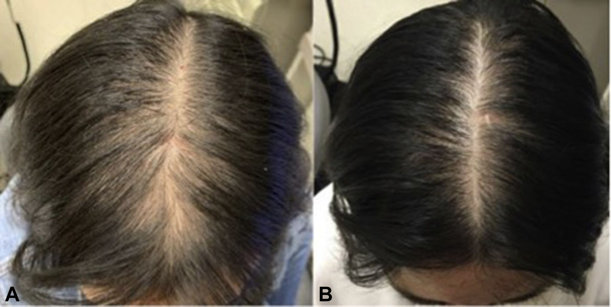 Pro Growth-Alopecia Anti-Thinning Hair Growth- With Haitian Vetiver-Jojoba Seed-Biotin- Argan-Peppermint Oil, Tea Tree Oil, Argan oil-P - Organic Hair Solution, LLC