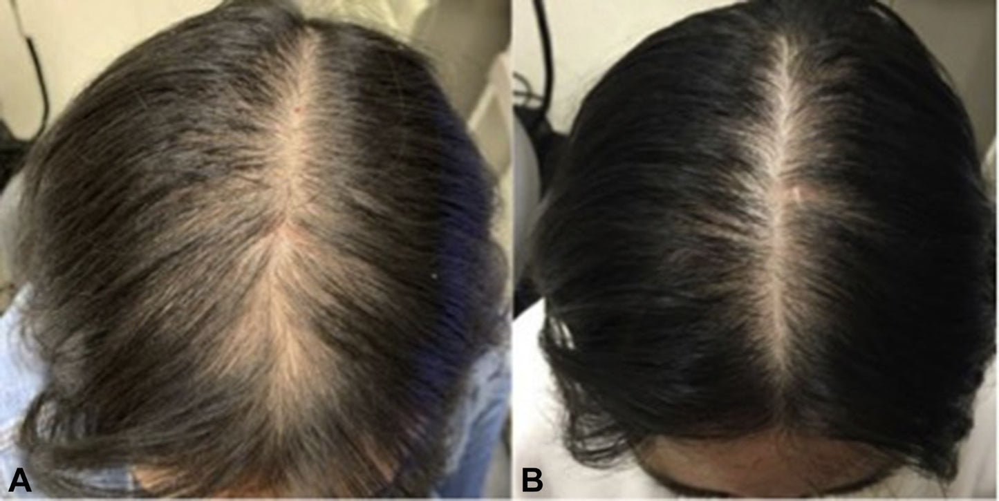 SHAMPOO & CONDITIONER & DETANGLER & EDGE REGROWTH & GROWTH TREATMENT OIL- An Anti Hair Loss treatment (Set 6) All Hair types, Sulfate Free - Organic Hair Solution, LLC